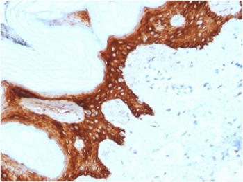 14-3-3 Sigma Antibody