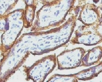 EGFR Antibody