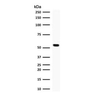 TOP1MT Antibody