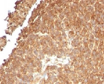 TOP1MT Antibody