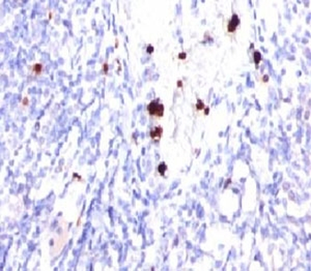 G-CSF Antibody
