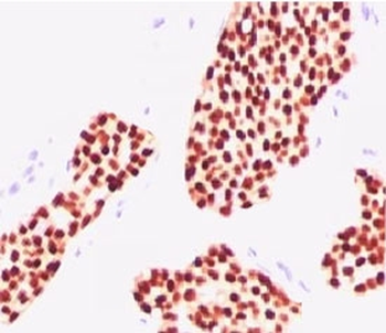 ER Antibody / Estrogen Receptor alpha