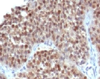 p21 Antibody