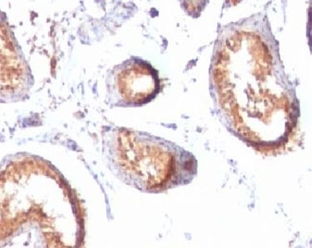 PMEL17 Antibody / Melanoma gp100