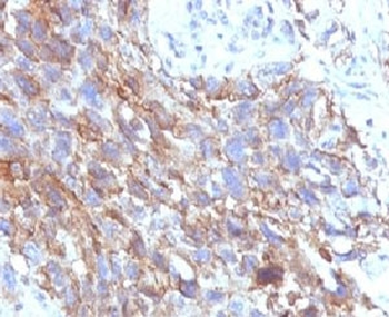 CD56 Antibody