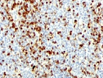 ZAP-70 Antibody
