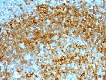 CD74 Antibody