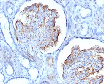 Recombinant WT1 Antibody / Rabbit Monoclonal