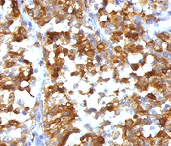 Recombinant MART-1 Antibody / Rabbit Monoclonal