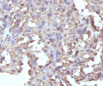 Recombinant TNF-alpha Antibody / Rabbit Monoclonal