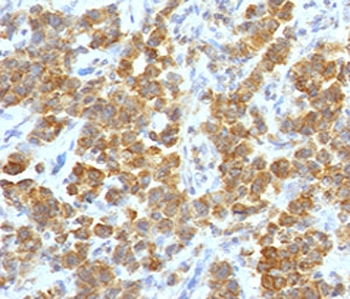 TL1A Antibody / VEGI / TNFSF15
