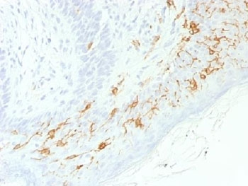 Recombinant CD1a Antibody / Rabbit Monoclonal