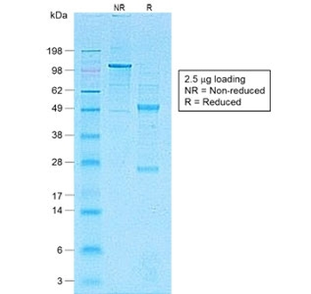 Recombinant CD1a Antibody / Rabbit Monoclonal