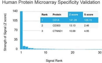 Recombinant CD1a Antibody / Rabbit Monoclonal