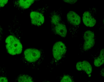 Topoisomerase II alpha Antibody / TOP2A
