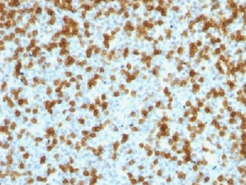 Recombinant PD1 Antibody / Rabbit Monoclonal
