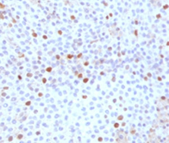 TOP2A Antibody / Topoisomerase II alpha