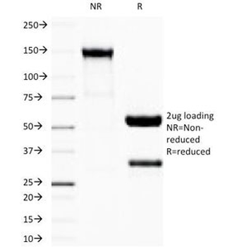 Recombinant IgG Antibody / Rabbit Monoclonal