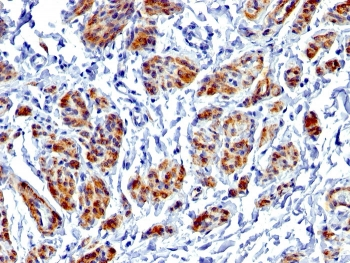 Recombinant Caldesmon Antibody / CALD1 / CAD (HMW)