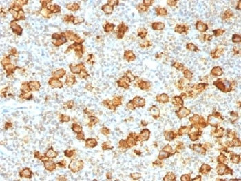 Recombinant CD30 Antibody / Rabbit Monoclonal