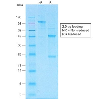 Recombinant CD30 Antibody / Rabbit Monoclonal