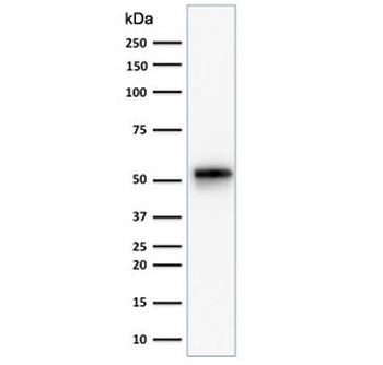 Recombinant Cytokeratin 7 Antibody / Rabbit Monoclonal