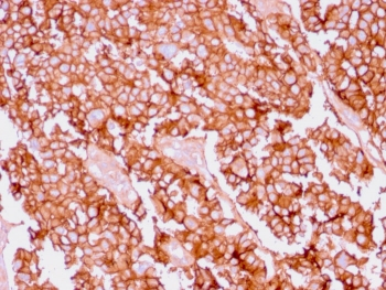 Recombinant Ep-CAM Antibody / Rabbit Monoclonal