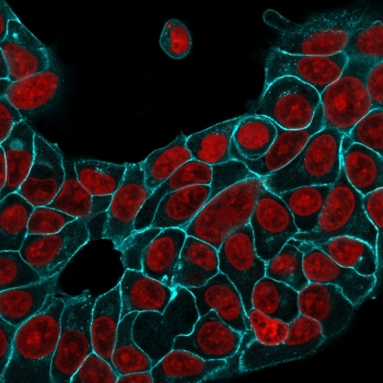 Recombinant Ep-CAM Antibody / Rabbit Monoclonal