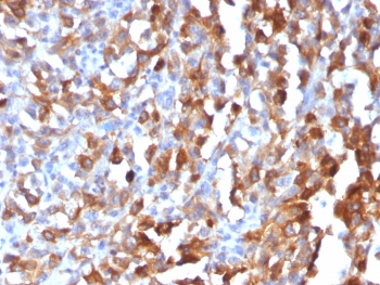 Recombinant MART-1 Antibody / Rabbit Monoclonal