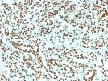Recombinant Histone H1 Antibody / Rabbit Monoclonal