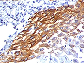 RPSA Antibody / 40S Ribosomal protein SA / Laminin Receptor 1