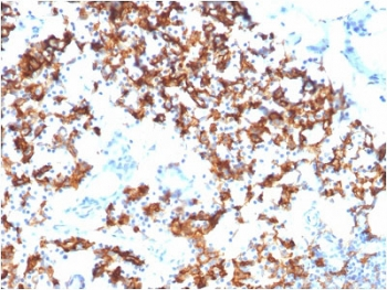 CD123 Antibody / IL3RA
