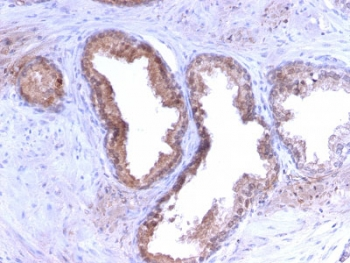 Recombinant PSA Antibody / Prostate Specific Antigen