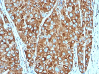 RPSA Antibody / 40S Ribosomal protein SA / Laminin Receptor 1
