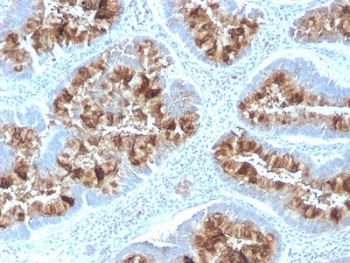 Recombinant Mucin-1 Antibody / Rabbit Monoclonal