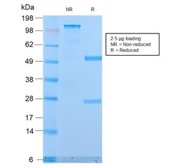 Recombinant Mucin-1 Antibody / Rabbit Monoclonal
