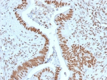 Nucleophosmin Antibody