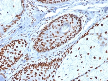 Nucleophosmin Antibody