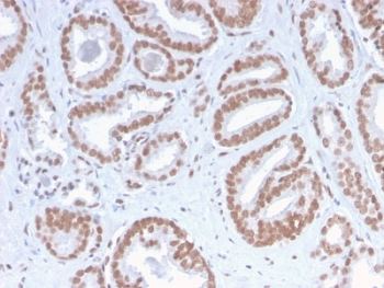 Recombinant ATRX Antibody / RAD54