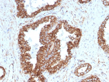 TMEPAI Antibody / PMEPA1