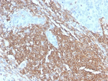 Recombinant CD45RB Antibody