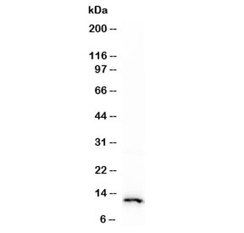 Recombinant S100A4 Antibody / FSP1