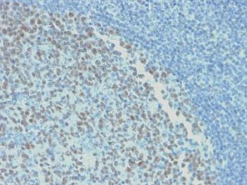 Recombinant Bcl6 Antibody