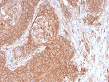 Recombinant Spectrin beta III Antibody / SPTBN2