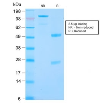 Recombinant Carbonic Anhydrase 9 Antibody