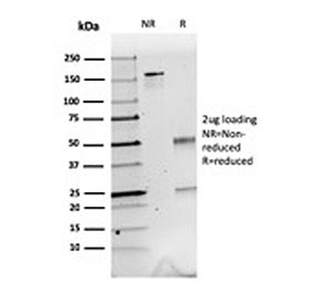 Calretinin Antibody / CALB2 / Calbindin 2