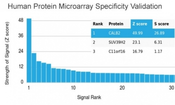 Calbindin 2 Antibody / CALB2 / Calretinin