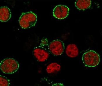 Recombinant CD6 Antibody