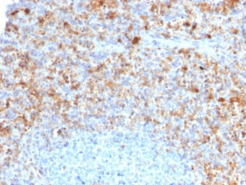 CD40 Ligand Antibody / TRAP / CD154