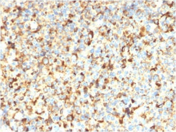 Recombinant CD63 Antibody / LAMP-3
